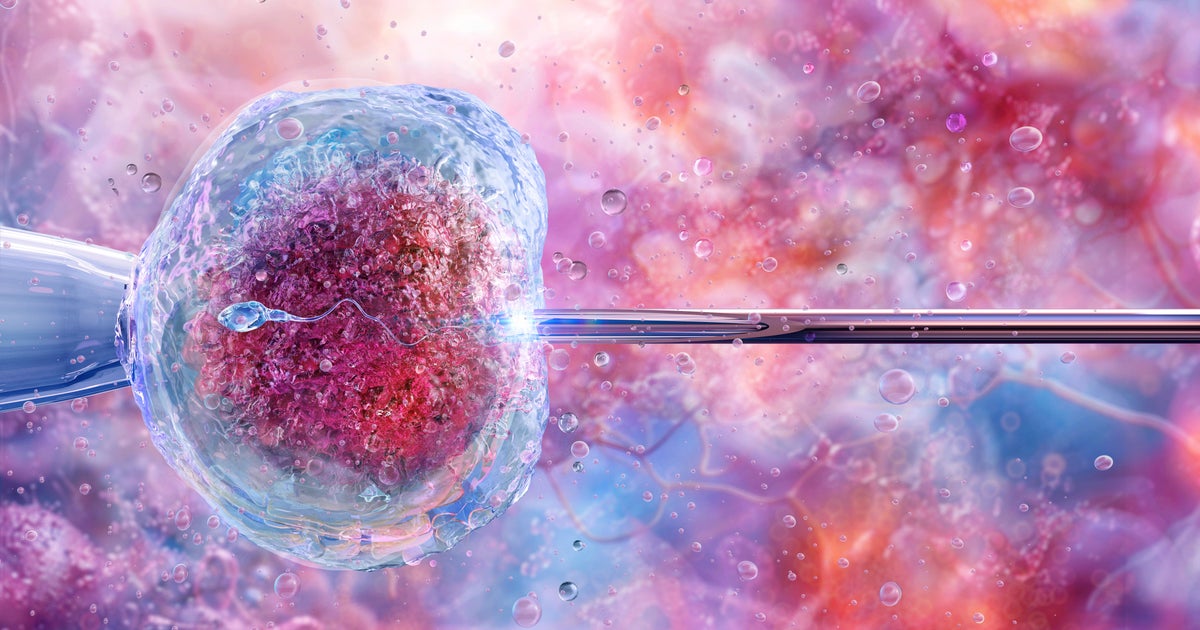 An illustration shows the process of artificial insemination or in vitro fertilization, known as IVF.